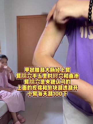 甲状腺的问题多看看,刮一刮,拍一拍。#刮痧
