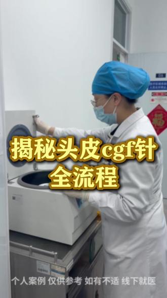 CGF生发针到底是什么 #石家庄脱发 #脱发怎么办 #生发针 #CGF生发针 #河北医科大学第三医院