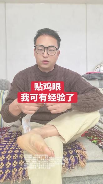 贴鸡眼我可有经验了 #鸡眼 #鸡眼跖疣 #鸡眼贴 #鸡眼怎么办 #脚上长鸡眼怎么办