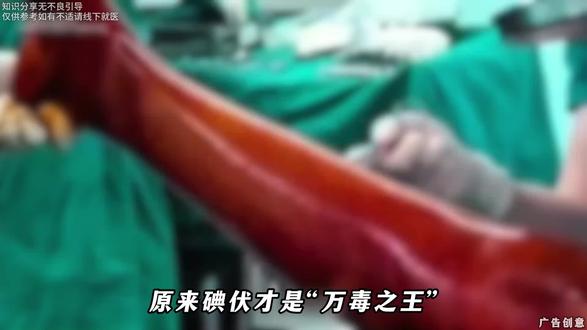 原来碘伏的作用这么大!