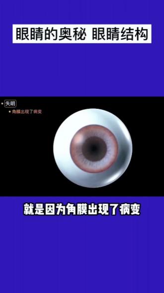 眼睛的奥秘~眼睛结构#保护好自己眼睛 #眼健康 #眼科科普
