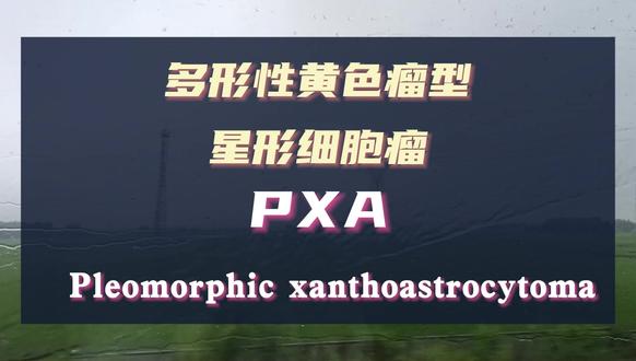 脑胶质瘤病理分类——多形性黄色瘤型星形细胞瘤PXA #抖出健康知识宝藏#women的健康我们帮#脑胶质瘤#星形细胞瘤#多形性黄色星形细胞瘤