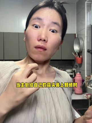 跟了我30多年的蒜头鼻终于……谁懂啊……#鼻翼贴 #万万没想到 #蒜头鼻 #亲测分享 #肉鼻头