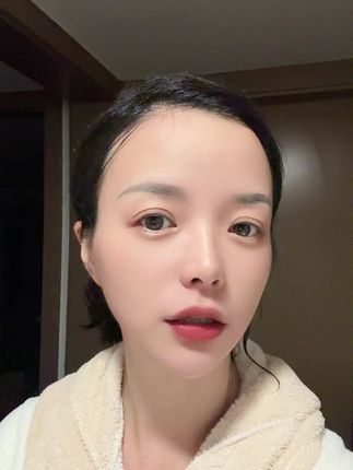 认识我的人都说,我哪都好,就是脸不干净,我一直想去黑科技,但是我又怕失败。我就想着坚持用这个产品试试,在我脸上真的很明显。一定要坚持用。现在,我姐姐,妈妈,朋友全部都被我推荐在用这个。