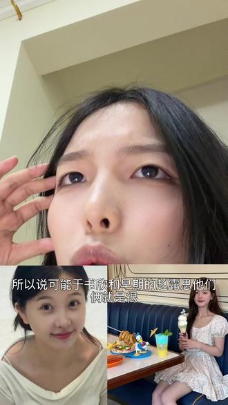 但是宝宝们我们不是明星不要一味的去追求上镜,健康才是最好的#赵露思#虞书欣#镜头畸变