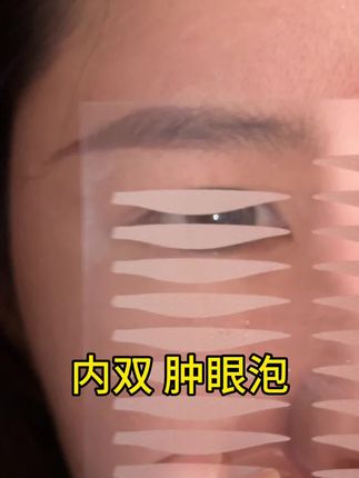 内双肿眼泡的3秒遍大外双#双眼皮怎么贴