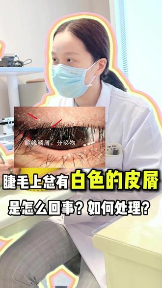 眼睫毛上为什么会有白色皮屑?#医学科普 #眼健康 #门诊日常