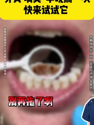 选对#牙膏真的很重要,别让一口黄牙影响自己的颜值!自从用了这个,牙齿干净了,嘴巴都是香香的!#牙膏#牙齿美白