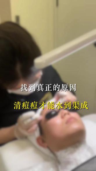 找到真正的原因,痘痘就能很快上岸#蚌埠 #黑头 #闭口