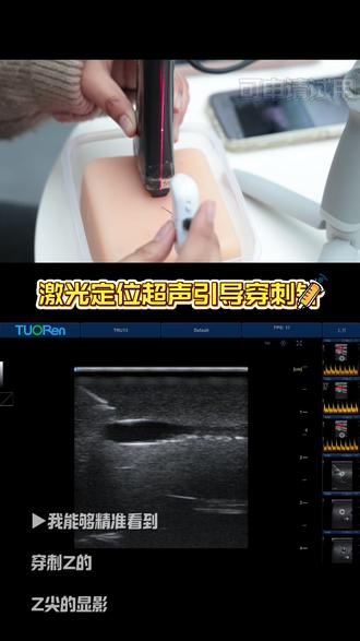 穿刺还在担心穿不准,激光定位装置来赋能,精准穿刺不是难题,小白也可轻松上手#穿刺针 #疼痛科 #医疗科技 #智能化