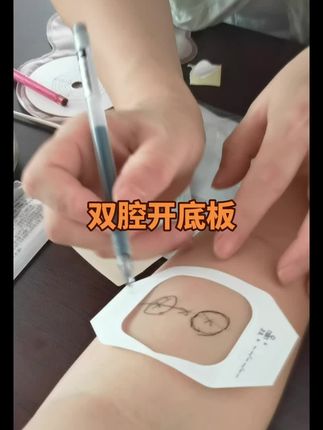 #早产儿宝宝健康成长 #早产儿宝宝 #王丽华讲早产#早产儿出院#造瘘宝宝