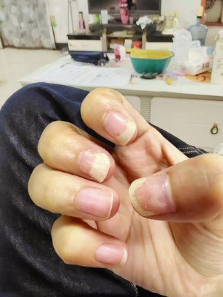 #日常分享 #强烈推荐 #指甲 #指甲盖 #脚指甲
