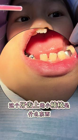 儿牙健康需要科普#儿童牙齿健康