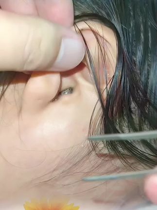 #强烈推荐 #掏耳朵 #掏耳神器 #可视采耳