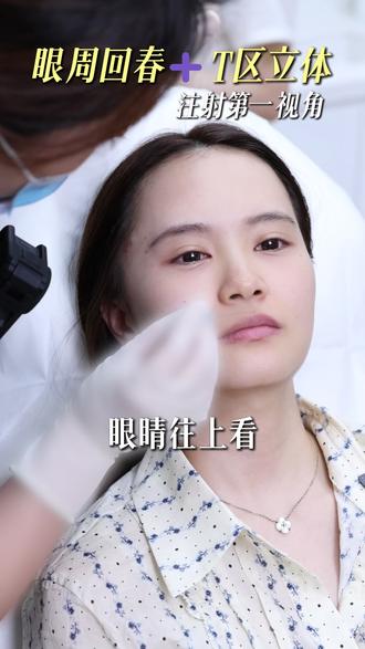 沉浸式感受 半张脸变美过程 #杭州谢惠芬 #眉弓注射 #鼻子注射 #眶周注射 #眼尾提升