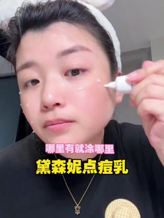 熬夜痘,姨妈痘,痘印脸,这个#黛森妮 的点痘乳简直就是标配~#点痘乳#护肤好物#平滑肌肤好东西#真的好好用