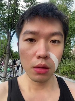 #法令纹贴 #法令纹 #鱼尾纹 #川字纹 #抬头纹