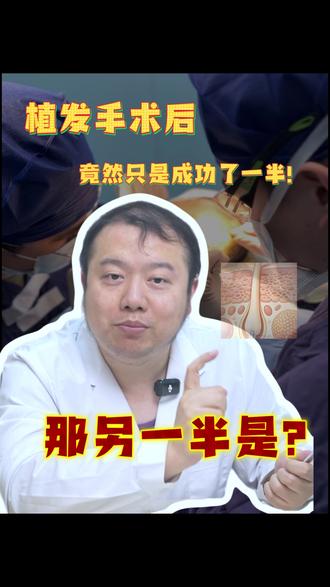 植发手术后竟然只是成功了一半!那另一半是? #健康科普 #抖出健康知识宝藏 #植发手术 #植发养发