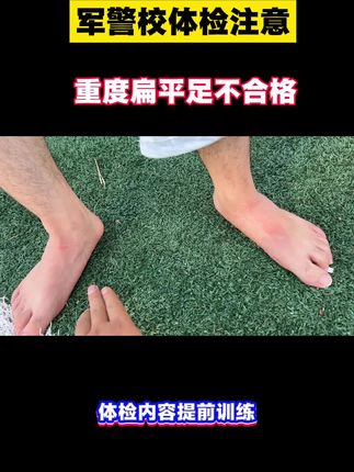 军警校体检方面的内容,一定要提前发现提前去做一些针对性训练#扁平足#警校提前批#公安类院校#扁平足改善训练