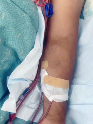 爸爸,病魔让你承受这样的痛苦,如果可以,我宁愿分担您的疼痛!爸爸请您坚持,我们都在您的身边!陪着您、护着您!会慢慢好起来。