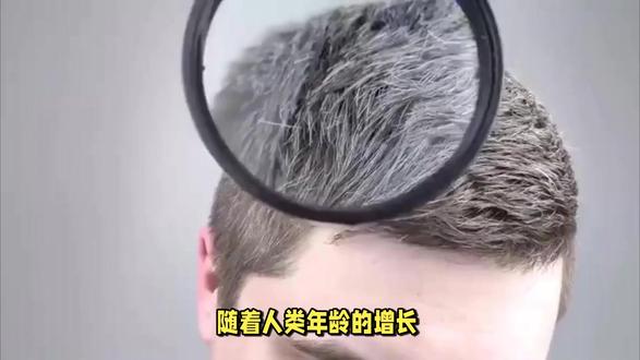 研究暗示:头发变白,可能是身体在主动降低癌症风险 我们一直以为白头发只是衰老,但最新研究发现,它可能是身体主动做出的“保护动作”。
色素干细胞在受到强烈损伤时,会选择停止分裂,主动退出循环,阻断异常基因继续复制。头发因此变白,但风险却被悄悄降低。
看似变老,其实是身体在替你挡风险。
#白发科普 #身体机制 #健康知识 #科学研究 #科普一下