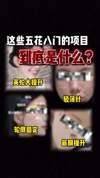 轻薄脸、英伦提升、轮廓固定,到底是什么? #轻薄脸 #英伦大提升 #轮廓固定 #筋膜提升 #变美避坑