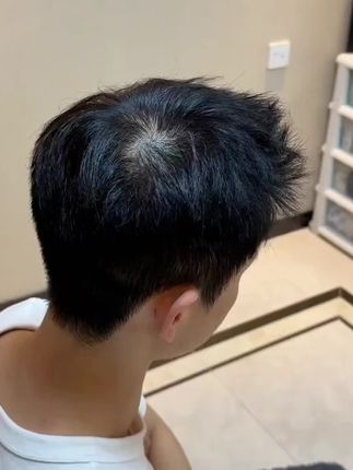 【平替好物】IMPS英派仕头发纤维粉稀疏遮秃头宽发缝发际线阴影粉#头发纤维粉 #发际线遮盖粉 #好物推荐🔥