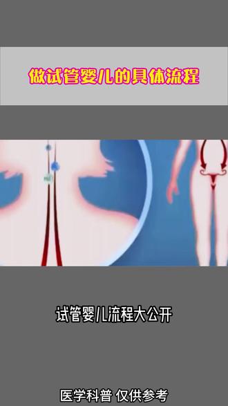 做试管婴儿的具体流程 #试管婴儿 #试管流程