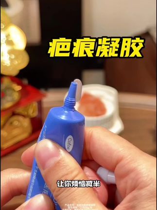 担心剖腹产留疤的姐妹们,一定要备上!!再就是家里有孩子的难免磕磕碰碰,千万别让孩子有遗憾,结疤体质的宝宝一定要坚持用,配方温和~真心不错的#可孚#可孚疤痕凝胶#宝妈推荐#剖腹产妈妈#宝宝疤痕