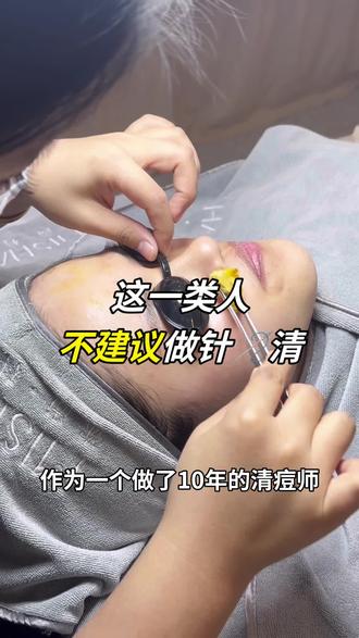 济南手工清痘|这一类人不建议🪡清 #皮肤管理中心 #美容护理日常💆 #同城美容护肤 #如何拯救痘痘肌 #皮肤管理不推销