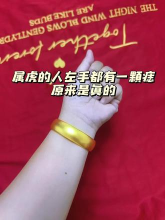 你有吗?属虎人左手痣有啥说法