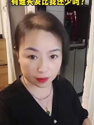 买一送一,瑶品防脱育发液#防脱#防脱生发 #防脱育发 #防脱固发