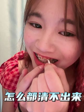 现在戴钢牙的姐妹都在用这个正畸牙刷#钢牙妹 #牙套 #正畸牙刷 #刷牙 #口腔健康