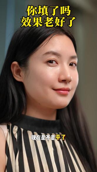 如果你也有这样的纹纹路路的问题,试试它,在家就能轻松淡纹!!!#护肤日常#抗皱祛纹#水光肌 #胶原蛋白面膜 #好物推荐🔥