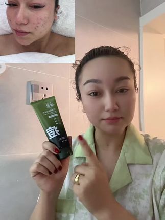 #热门 脸上有痘痘的宝贝们试一下这洗面奶真的好用,我用了三个月,用了4瓶以后给你们推荐#好皮肤 #自用好物分享 #护肤分享 #洁面乳