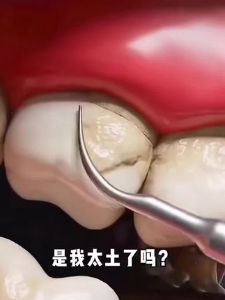 选对牙膏很重要!!这个牙膏刷完牙白白又香香的,真的太快乐了!#美白牙膏 #强烈推荐 #女生必备 #参半牙膏