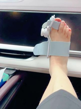 拇外翻快没啦#拇外翻 #大脚骨