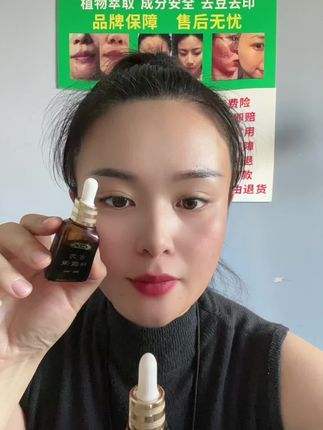痘痘真的没有了