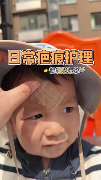 日常护理要坚持,我是三天左右护理一次的哦,贴法分享一下#减张贴#疤痕护理#日常护理#伤口#美皮护