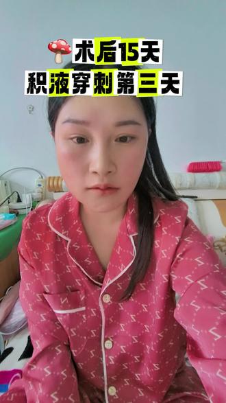 #磨骨三件套 #积液肿胀 #磨骨后遗症 慢慢在变好,想给大家发对比图看看,但是我不会剪辑😄姐妹们教教我
