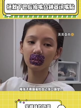 跟着#张予曦 一起贴#口呼吸矫正贴嘴不凸了,下巴也不后缩了,每天早上起来口不干了,无痛变美真的绝绝子!#闭嘴贴 #口呼吸纠正#下巴后缩