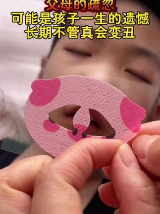 孩子习惯性张嘴,睡觉也张嘴,千万别忽视,一定要及时纠正,长时间不管真的会越来越丑#张嘴睡觉会变丑 #张嘴睡觉的危害 #凸嘴 #育儿经验分享