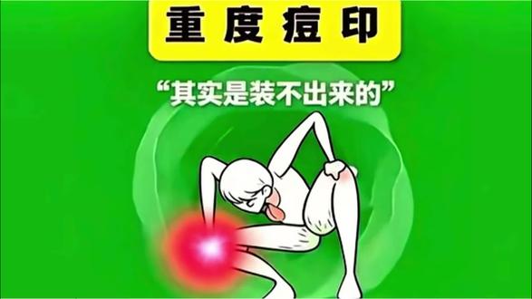 满脸痘印,别人不愿意说的,今天我来说#痘印 #护肤 #祛痘印 #高考 #618活动