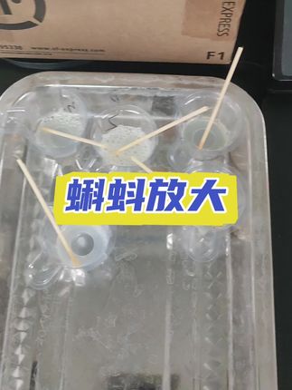 年纪轻轻就那么少,太可怜了#显微镜下的世界 #别点进去里面太神奇了 #希望能帮到你 #看过来 #万能的抖音