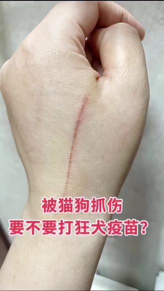猫咪狗狗抓伤咬伤注意哦,刚开始不知道就马上去打狂犬疫苗了,后来朋友说可以给猫咪做个狂犬抗原检测,他们家2个猫都检测过,推荐了这个狂犬抗原检测卡纸,家人们可以试试!#养猫知识#狂犬病#被猫抓伤#被猫狗抓伤#被猫抓伤一点要打疫苗吗