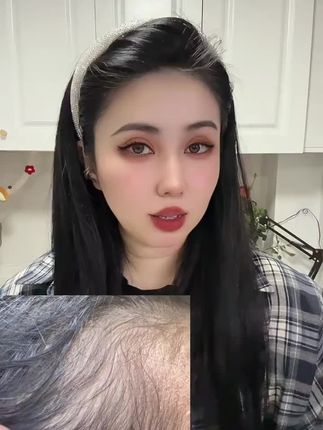 #pit #头虱怎么去除 #内容过于真实