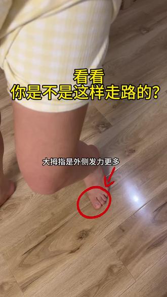 可别忽视大脚趾、它可是直腿的开关!把大脚趾摆正把开关打开✅ #大脚趾 #拇指外翻 #小腿外翻 #膝内扣 #直腿