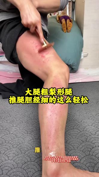 如果都推推这里大腿粗梨形腿的人会少一半,久坐久站快看看吧 #万物皆可逐玉刮痧 #养生就是养健康 #刮痧排毒 #经络疏通#生活小妙招