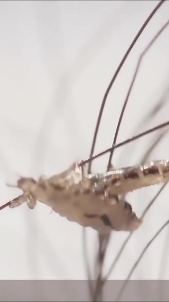 恐龙时代就有虱子啦! 在 6500 万年前恐龙统治地球时,虱子就已存在,且可能寄生在恐龙身上!#头虱 #头虱洗发水 #头虱怎么去除 #虱子 #虱子卵