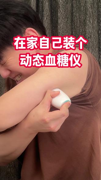 亲测动态血糖仪安装和准度!! 第一次用,总的来说还是挺准的,在血糖剧烈波动的时候感觉不准,而且有滞后性,配合指尖血糖校准一下就可以#动态血糖仪 #动态血糖仪是智商税吗 #测血糖